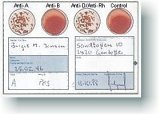 Eldoncard Blood Type Home Test Kits(2ea Eldoncard Test Kits) Test Results Guaranteed! Eligible for FREE Shipping!