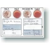 Blood Type Kit - Also Includes: 1 Eldoncard, 2 lancets, gauze, alcohol wipe, micropipette