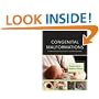Congenital Malformations: Evidence-Based Evaluation and Management