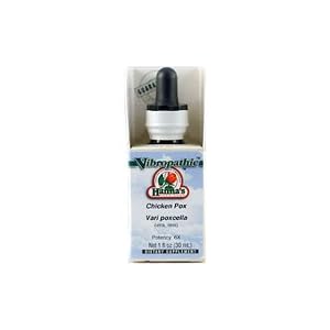 Get Complete Assistance from Chicken Pox