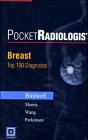 Breast, 1 CD-ROM Top 100 Diagnoses. For PDA, Handhelds, Pocket PCs (PocketRadiologist)