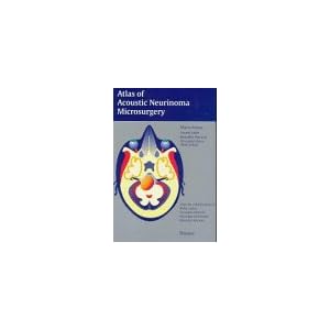 Atlas of Acoustic Neurinoma Microsurgery M. Sanna