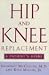 Book Hip and Knee Replacement: A Patient's Guide