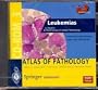 CD-ROM Atlas of Pathology, 3: Leukemias <CD-ROM Windows>