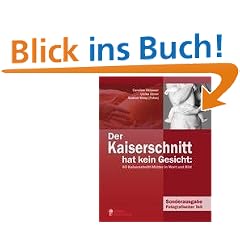 Der Kaiserschnitt hat kein Gesicht: 60 Kaiserschnitt-M�tter in Wort und Bild: Sonderausgabe Fotografischer Teil