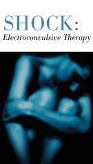 Shock: Electroconvulsive Therapy (404) CD-ROM