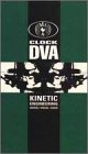 Review Mvd Visual  / Kinetic Engineering