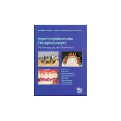 Implantatprothetische Therapiekonzepte
