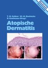 Dermatitis