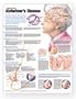 Understanding Alzheimer's Disease Anatomical Chart Laminated