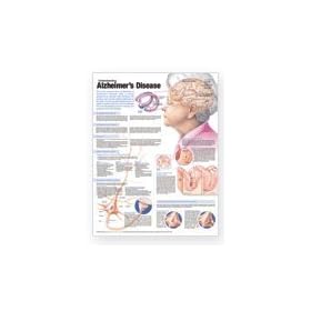 Understanding Alzheimer's Disease Anatomical Chart Laminated