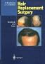 Hair Replacement Surgery: Textbook and Atlas