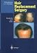 Hair Replacement Surgery: Textbook and Atlas (Hair Replacement Surgery)
