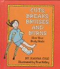 Cuts, Breaks, Bruises, and Burns: How the Body Heals