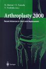 Arthroplasty 2000: Recent Advances in Total Joint Replacement