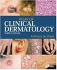 Atlas of Clinical Dermatology