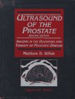 Ultrasound of the Prostate: Imaging in the Diagnosis and Therapy of Prostatic Disease