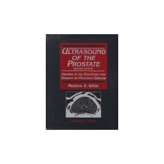 Ultrasound of the Prostate: Imaging in the Diagnosis and Therapy of Prostatic Disease by Matthew D. Rifkin and Rifkin