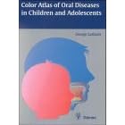Color Atlas of Oral Diseases in Children and Adolescents