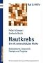 Hautkrebs - Ein oft untersch�tztes Risiko: Risikofaktoren, Diagnostik, Therapie und Prognose