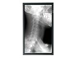 65IN LCD 1920X1080 PNG655UP 3YR PNG655RU with Protective Overlay