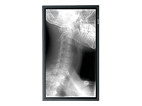 65IN LCD 1920X1080 PNG655UP 3YR PNG655RU with Protective Overlay