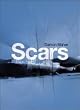 Scars