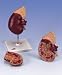 Kidney with Adrenal Gland, 2-part