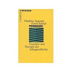 Psoriasis: Ursachen und Therapie der Schuppenflechte