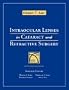 IOL Surgery : Intraocular Lenses in Cataract and Refractive Surgery