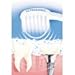 New Emmi-dent Professional 6 Ultrasound Electric Toothbrush Ultra Clean Brighten