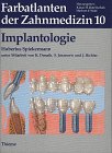 Farbatlanten der Zahnmedizin, Bd.10, Implantologie: Bd. 10