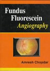 Fundus Fluorescein Angiography