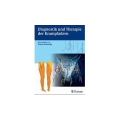 Chirurgie der Krampfadern