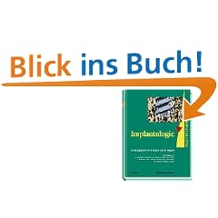 Praxis der Zahnheilkunde, 14 Bde. in 16 Tl.-Bdn., Bd.13, Implantologie