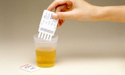 JANT ACCUTEST 5-PANEL URINE DRUG SCREEN MultiDrug Screen 5 (NIDA 5 combo) (AMP-COC-OPI-PCP-THC), 25/bx