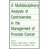 A Multidisciplinary Analysis of Controversies in the Management of Prostate Cancer