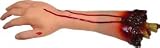 Severed Arm