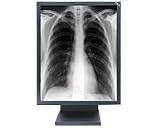 NEC MultiSync MD21GS-2MP-BK-CB2 - Flat panel display - 2MP - grayscale - TFT - 21.3 - 1600 x 1200 - 900 cd/m2 - 700:1 - 35 ms - 0.27 mm - DVI-D, VGA