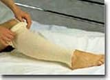 Stockinette Drs 4 In X 25 Yd