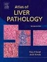 Atlas of Liver Pathology (ATLAS OF SURGICAL PATHOLOGY)