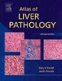 Atlas of Liver Pathology (Atlases in Diagnostic Surgical Pathology)