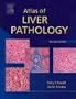 Atlas of Liver Pathology, 2e (ATLAS OF SURGICAL PATHOLOGY)