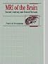 MRI of the Brain: Normal Anatomy and Normal Variants, 1e