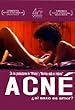Acné Ntscregion 4 Dvd Importlatin America by Federico