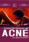Acné [*Ntsc/region 4 Dvd. Import-latin America] by Federico Veiroj (English subtitles)