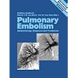 Pulmonary Embolism: Epidemiology, Diagnosis and Treatment by  OUDKERK