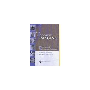 Click here to buy Thoracic Imaging: Pulmonary and Cardiovascular Radiology by W. Richard Webb and Charles B Higgins.