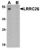 LRRC26 Peptide (Peptide)
