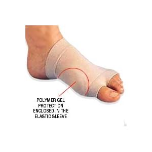 BUNION, LARGE TOE, LARGE BONE, BUNIONS, BUNION TREATMENT, WHAT IS BUNION, CAUSES OR BUNION, TREATMENT OF BUNION, BUNION TREATMENT, BUNION FOOT, BUNION REMOVAL SURGERY, PODIATRIST , HALLUX VALGUS, TOE BUNION bunion, large toe, large bone, bunions, bunion treatment, what is bunion, causes or bunion, treatment of bunion, bunion treatment, bunion foot, bunion removal surgery, podiatrist , hallux valgus, toe bunion